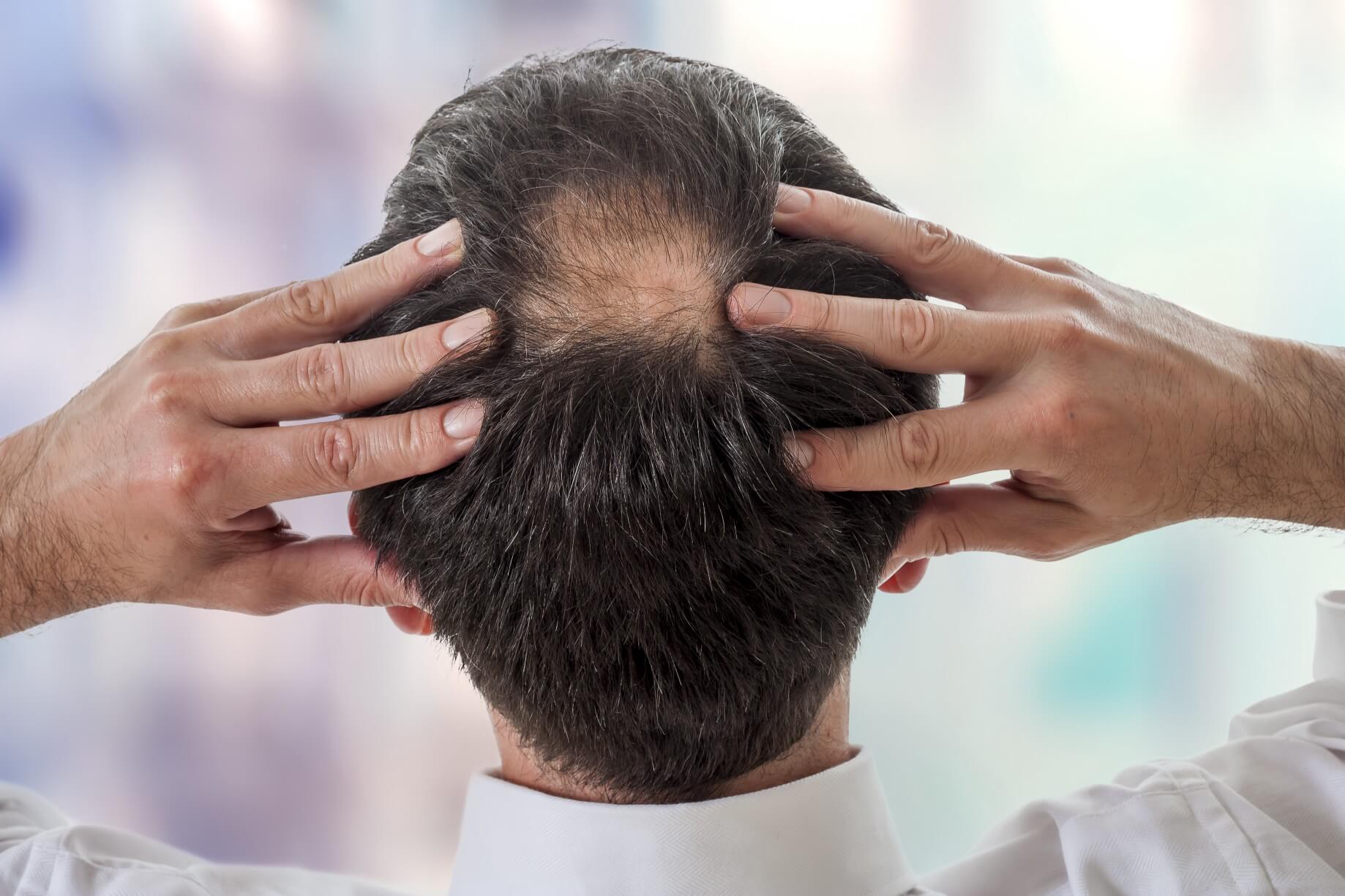 can-hair-transplant-cause-a-nerve-injury-zty-hair-transplantation-turkey