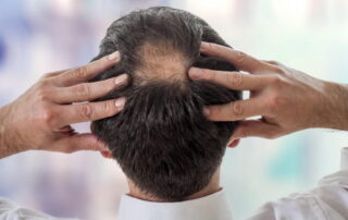 Une greffe de cheveux peut-elle causer une lésion nerveuse ?