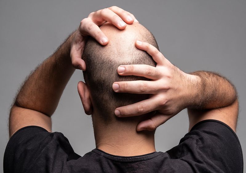 Ursachen für Haarausfall bei Männern - zty health turkey