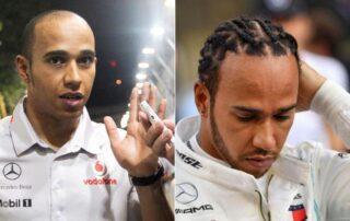 La greffe de cheveux de Lewis Hamilton