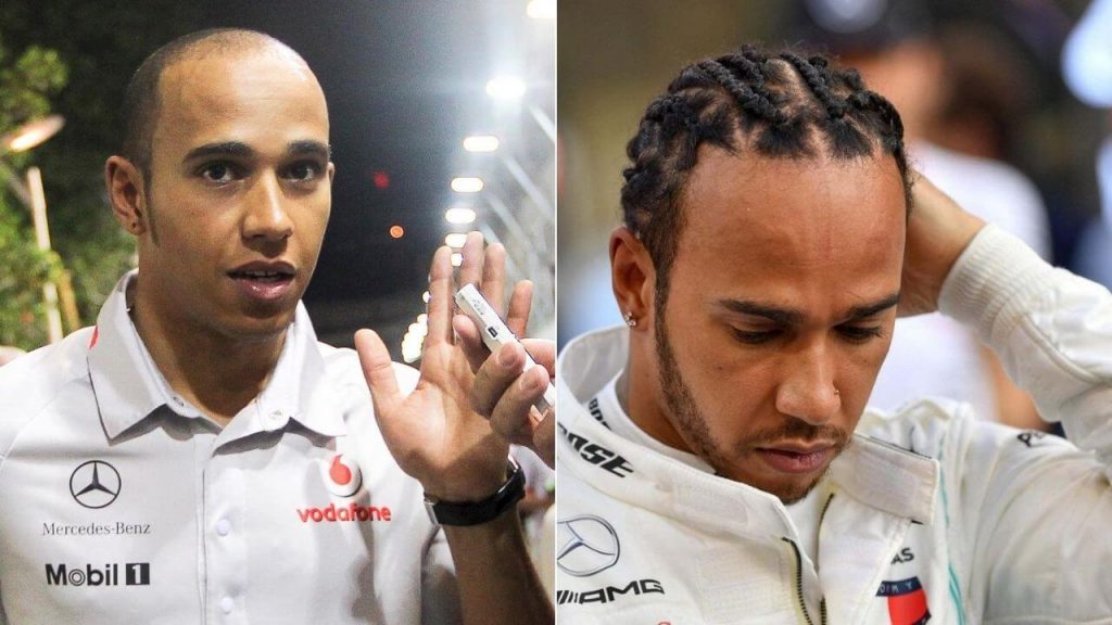 La greffe de cheveux de Lewis Hamilton