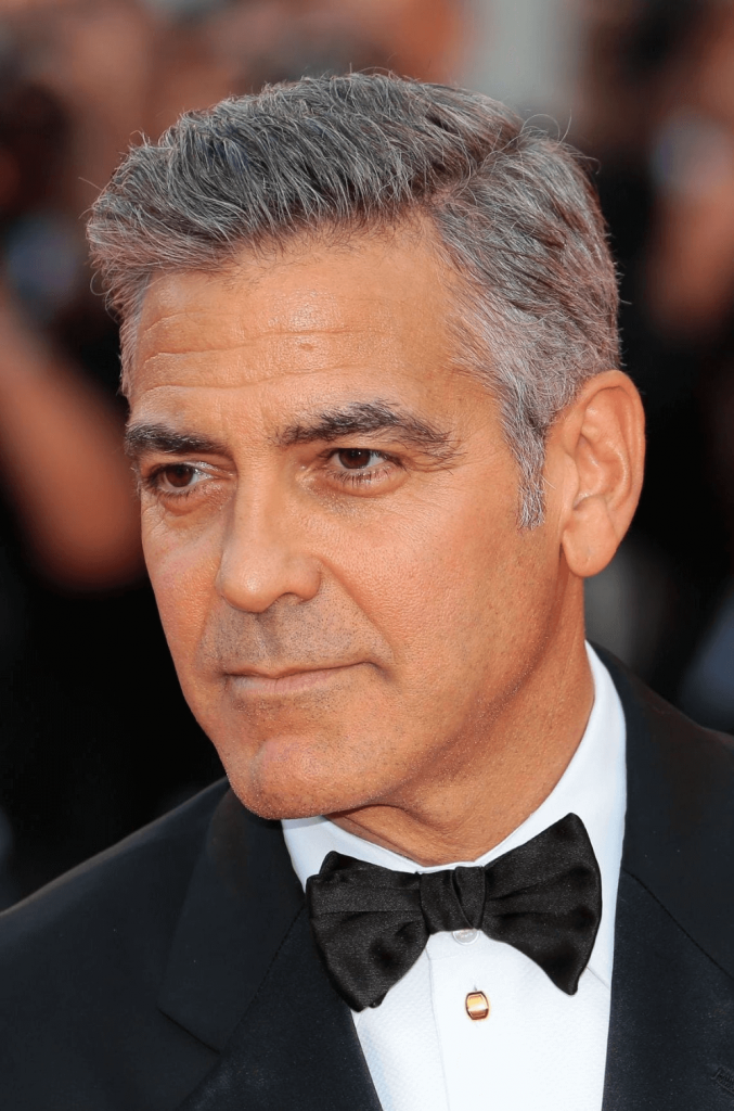 Greffe de cheveux de George Clooney