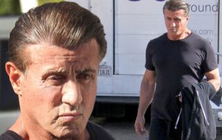 Greffe de cheveux de Sylvester Stallone