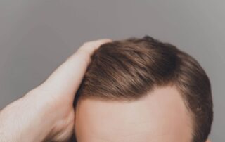 Prévention des Mauvaises Greffes de Cheveux