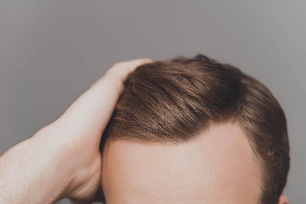 Prévention des Mauvaises Greffes de Cheveux