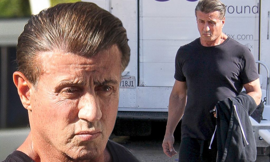 Trapianto di Capelli di Sylvester Stallone