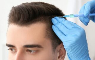 Welche Haararten werden für eine Haartransplantation verwendet?