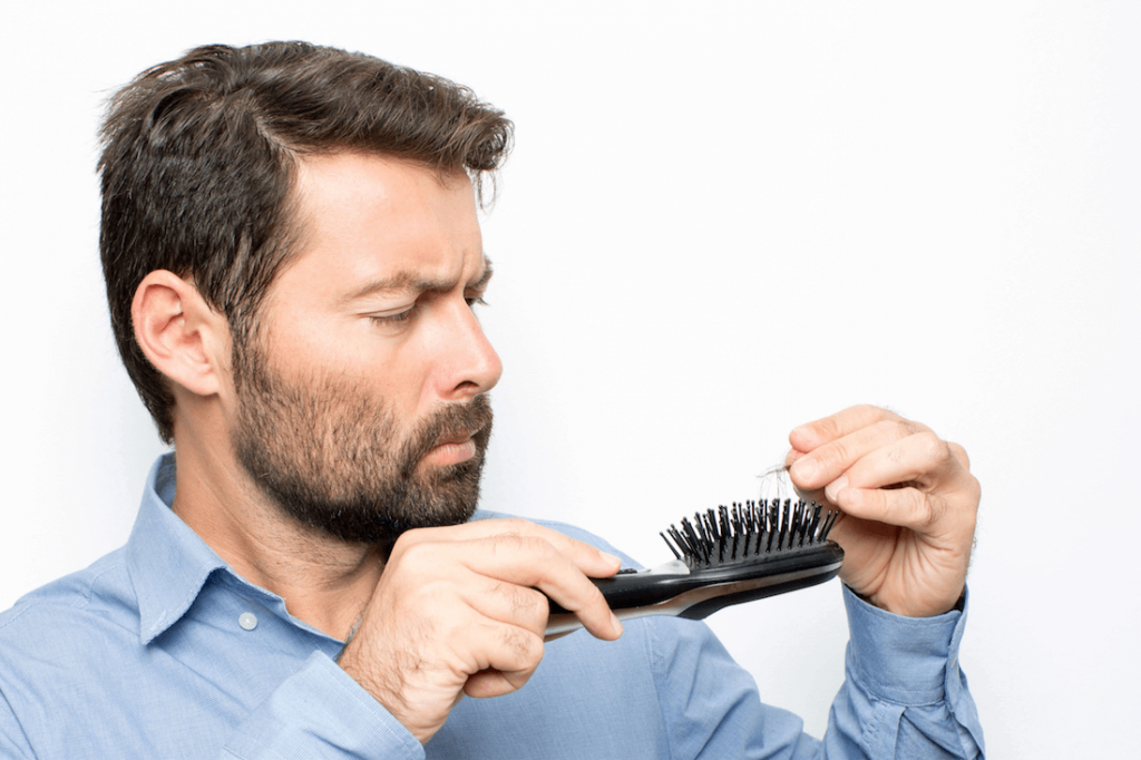 Well known Dutch people who opted for a hair transplant - Zty Hair Transplantation Istanbul