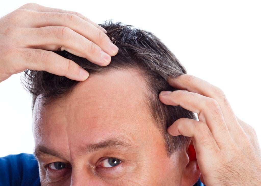 Hair transplant Repair